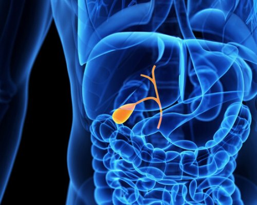 Laparoscopic Cholecystectomy