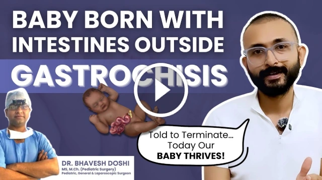 Baby Born With Intestine Outside—Gastroschisis Treatment